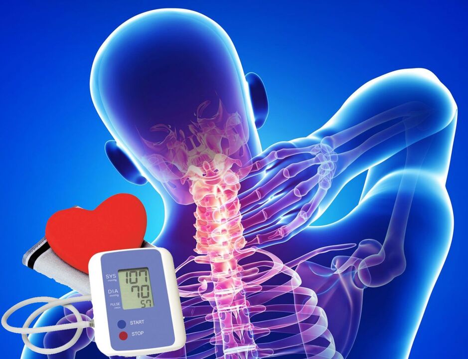 Klopiranje krvnega tlaka za osteohondrozo materničnega vratu