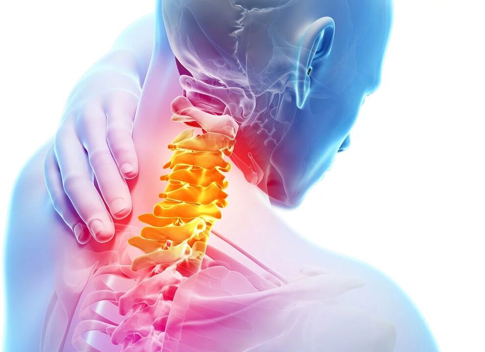 Osteohondroza materničnega vratu
