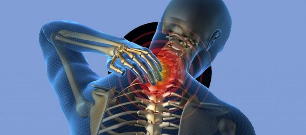 Osteohondroza vratne hrbtenice