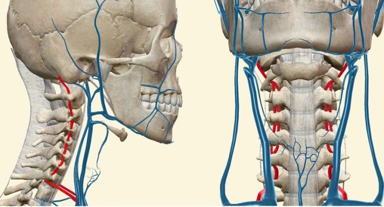 Vaskularni sindrom pri osteohondrozi